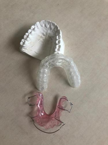 Odcisk zgryzu i aparaty ortodontyczne